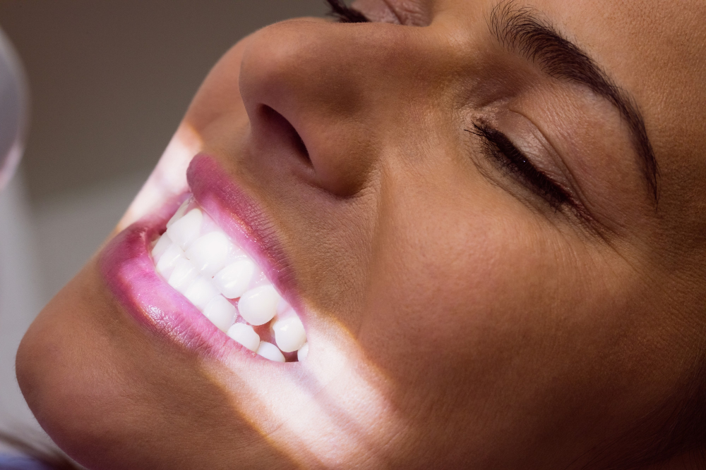 Unimed Odonto lança produto para empresas com foco em implantes e clareamento