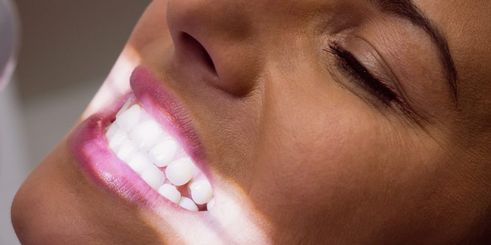 Unimed Odonto lança produto para empresas com foco em implantes e clareamento